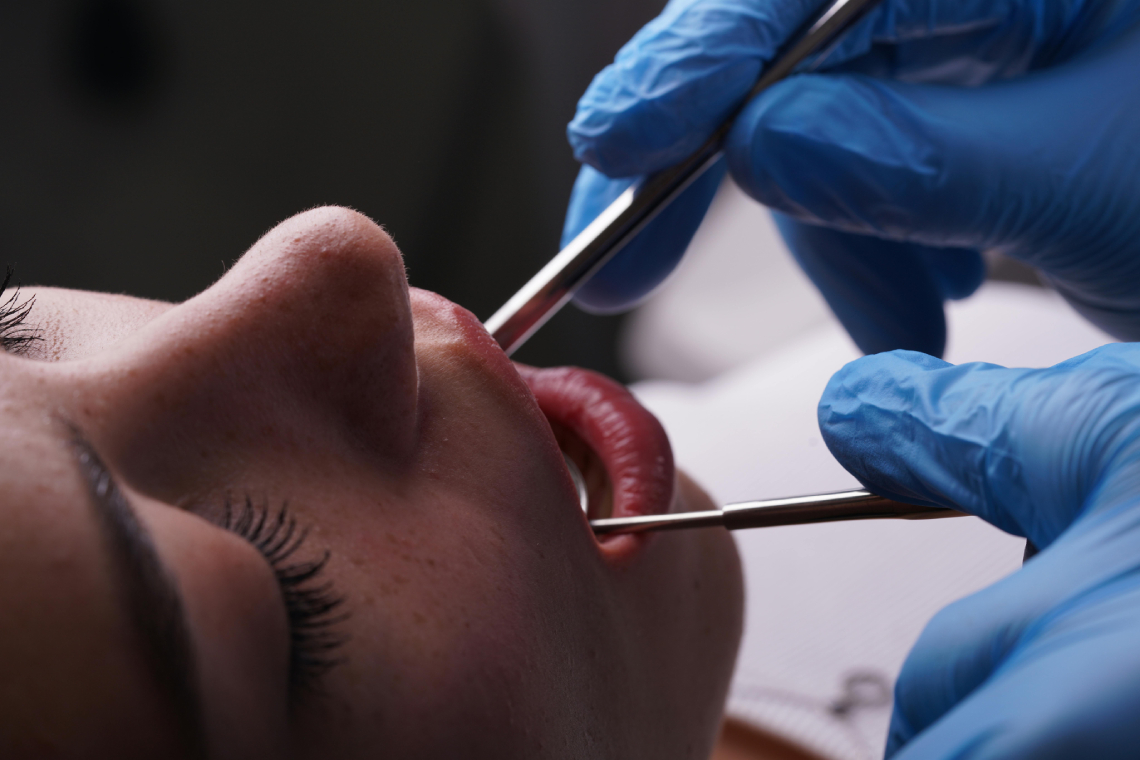 Dental Treatments
