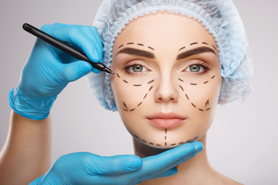 Rhinoplasty
